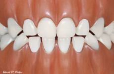 illustration-of-baby-teeth